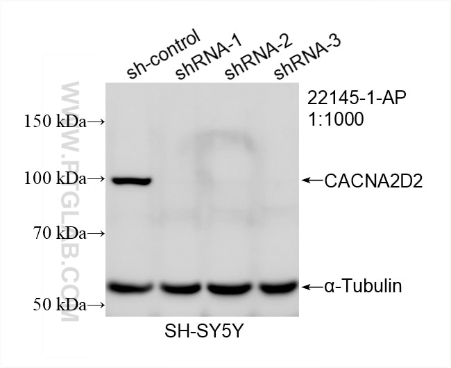 Western Blot (WB) analysis of SH-SY5Y cells using CACNA2D2 Polyclonal antibody (22145-1-AP)
