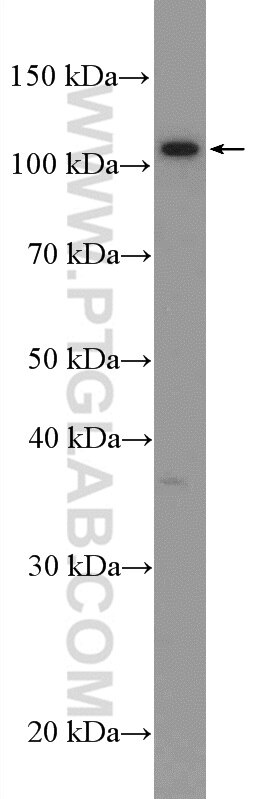 Western Blot (WB) analysis of mouse brain tissue using CACNA2D3 Polyclonal antibody (21711-1-AP)