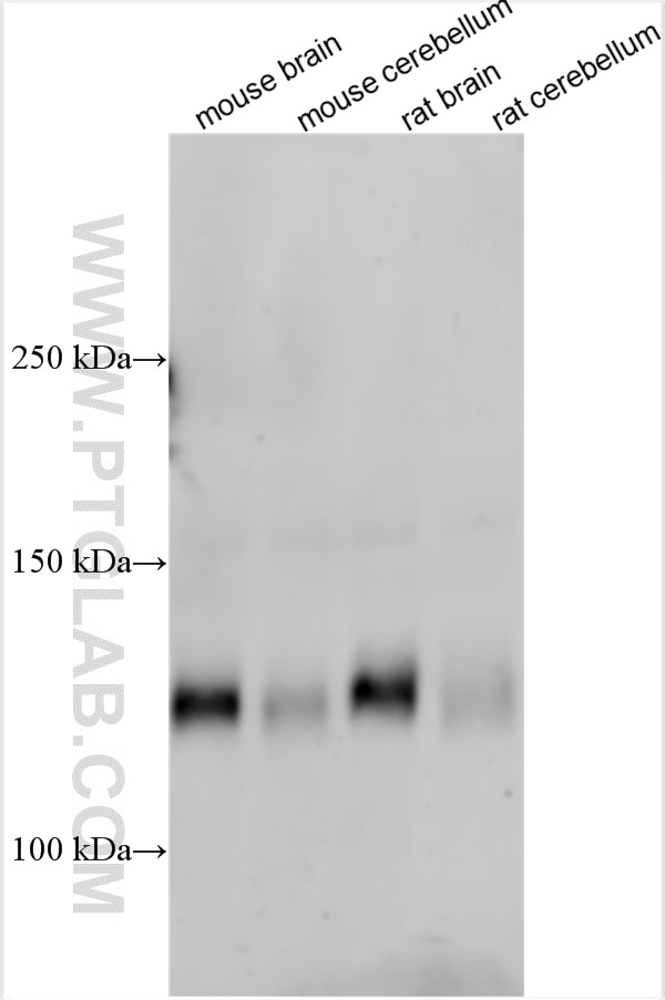 Western Blot (WB) analysis of various lysates using CACNA2D3 Polyclonal antibody (21711-1-AP)
