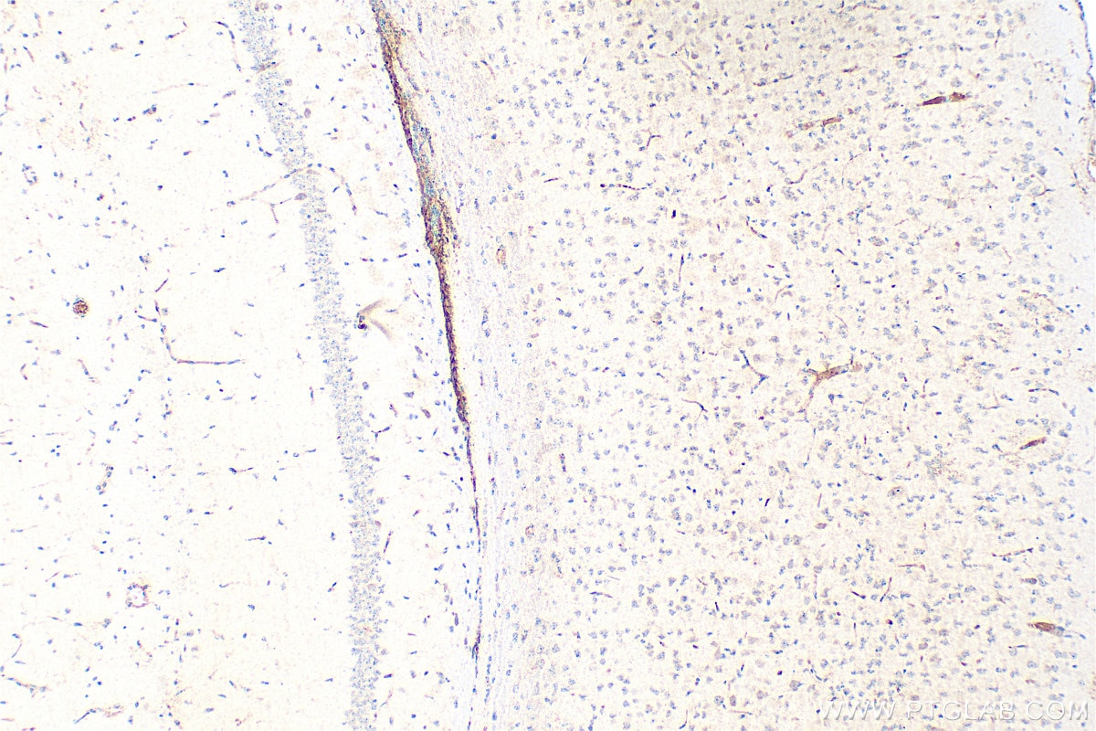 Immunohistochemistry (IHC) staining of mouse brain tissue using CACNA2D4 Polyclonal antibody (26674-1-AP)