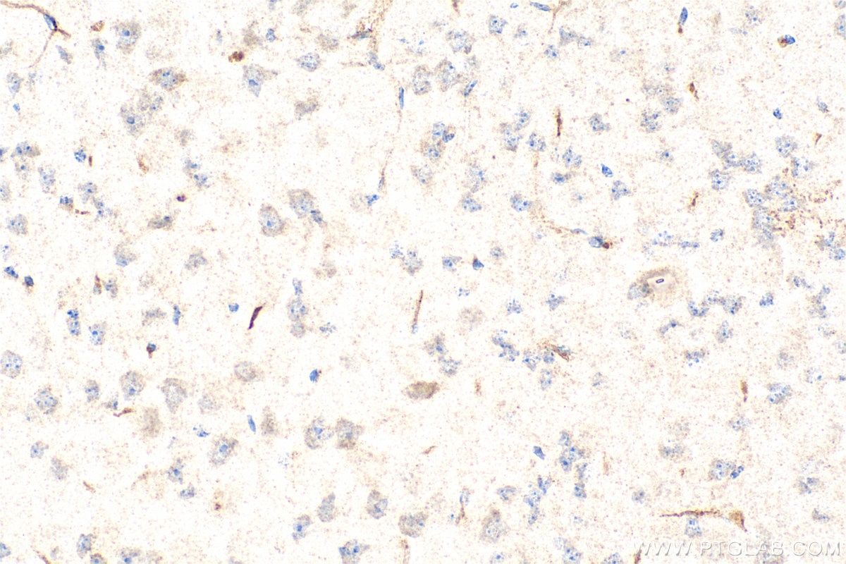 Immunohistochemistry (IHC) staining of mouse brain tissue using CACNA2D4 Polyclonal antibody (26674-1-AP)