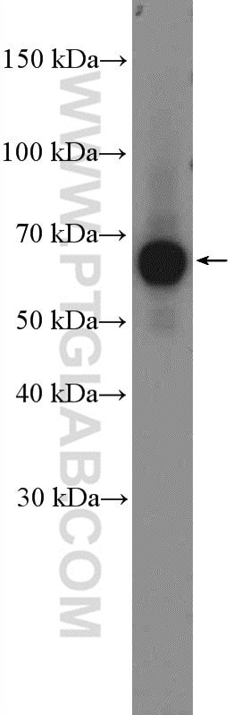Western Blot (WB) analysis of mouse skeletal muscle tissue using CACNB1 Polyclonal antibody (13039-1-AP)