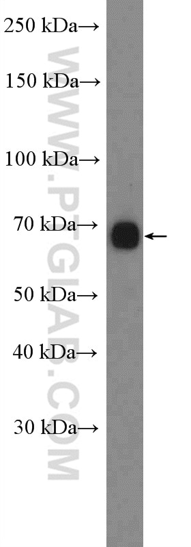 Western Blot (WB) analysis of mouse brain tissue using CACNB1 Polyclonal antibody (13039-1-AP)