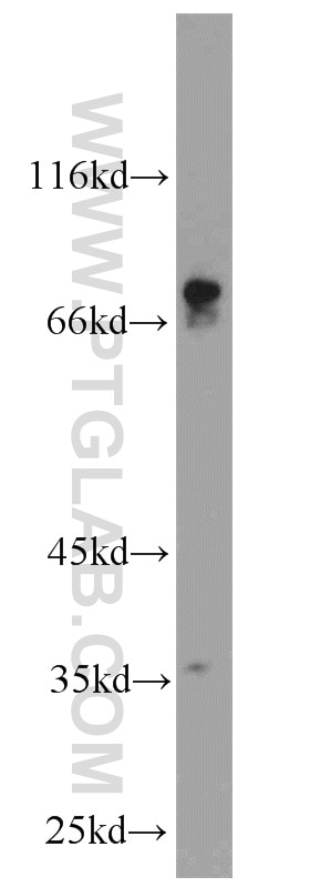 Western Blot (WB) analysis of mouse brain tissue using CACNB1 Polyclonal antibody (13039-1-AP)
