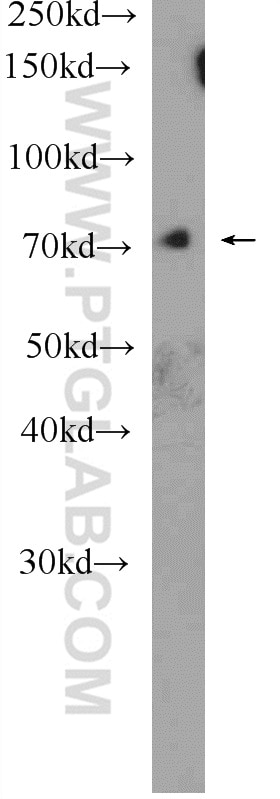 CACNB2 Polyclonal antibody