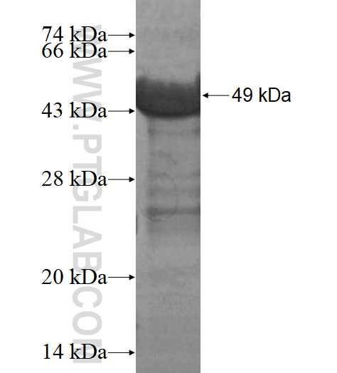 CACNB2 fusion protein Ag16858 SDS-PAGE