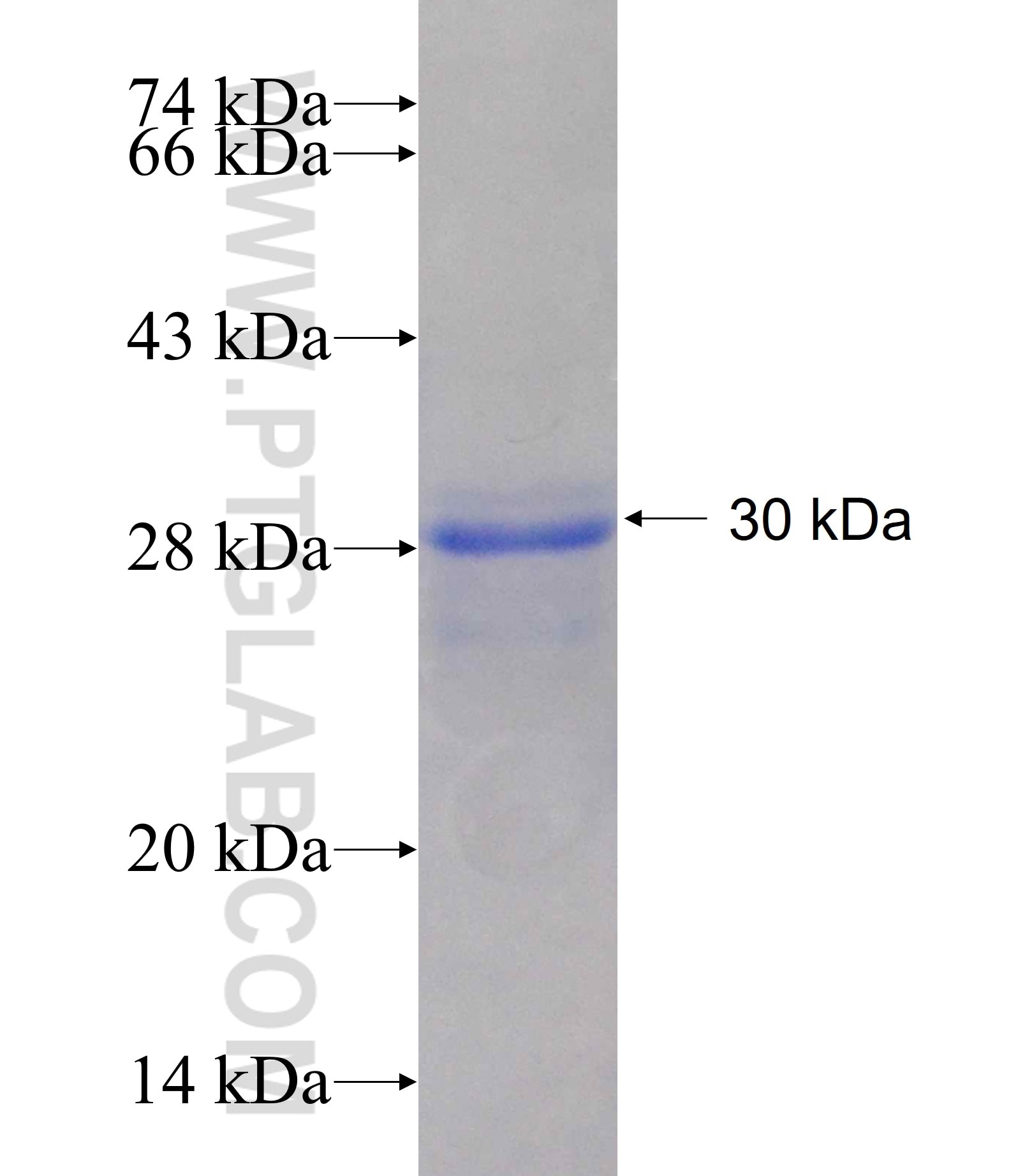 CACNB2 fusion protein Ag17989 SDS-PAGE