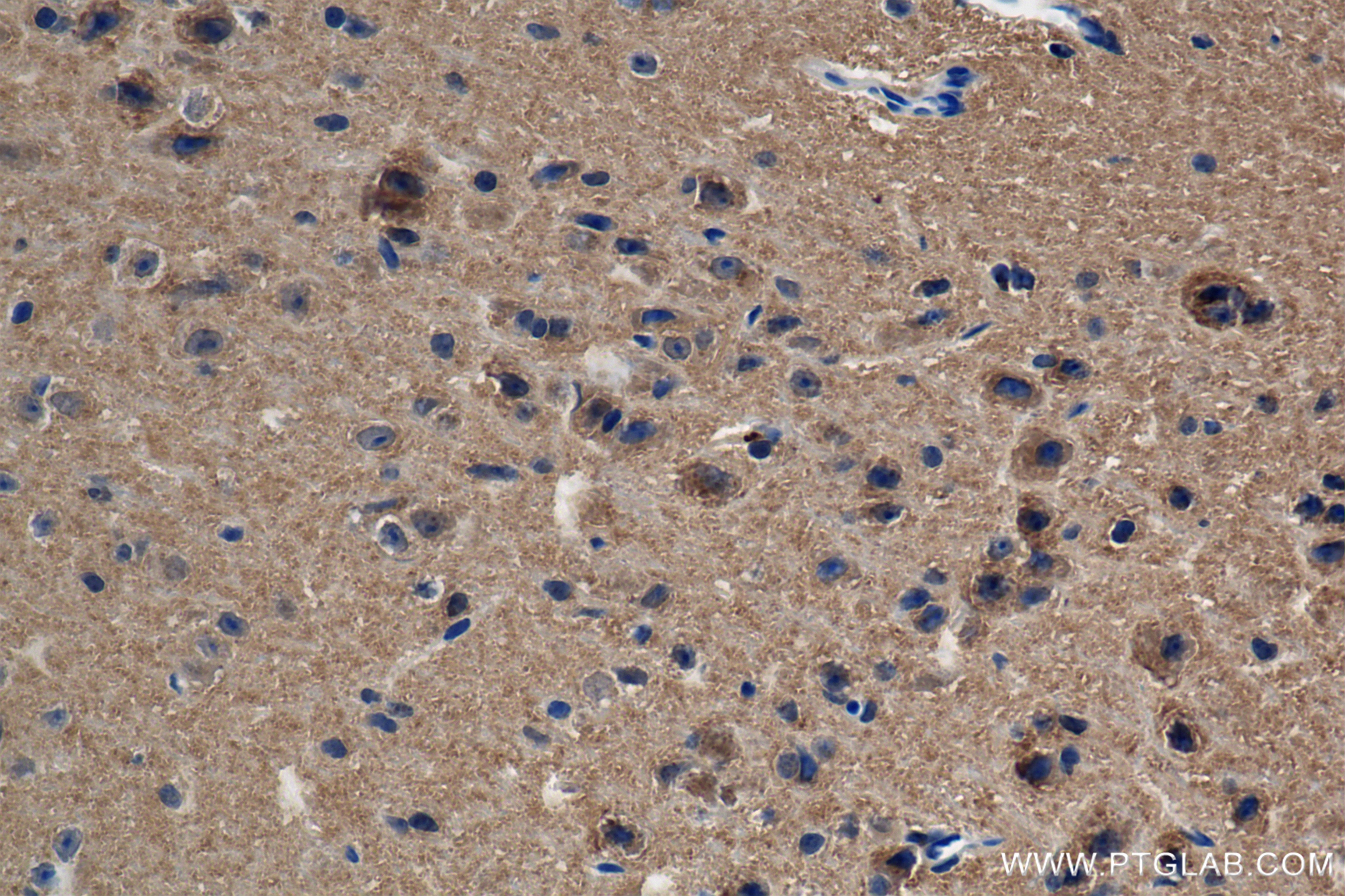 Immunohistochemistry (IHC) staining of mouse brain tissue using CACNB3 Recombinant antibody (84762-3-RR)