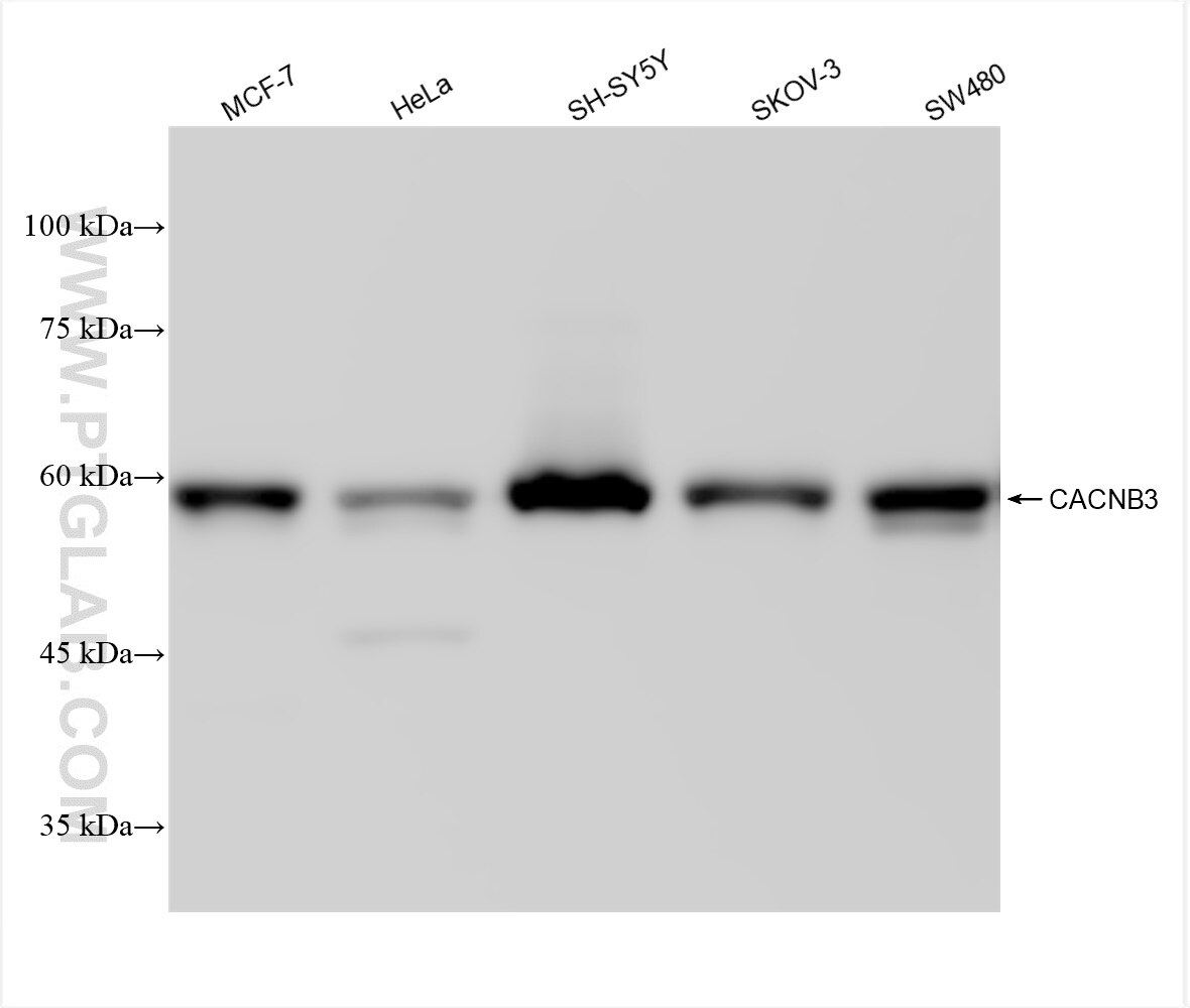 Western Blot (WB) analysis of various lysates using CACNB3 Recombinant antibody (84762-3-RR)