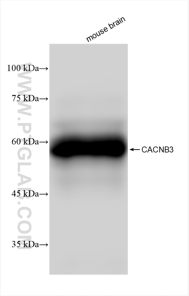 Western Blot (WB) analysis of various lysates using CACNB3 Recombinant antibody (84762-3-RR)