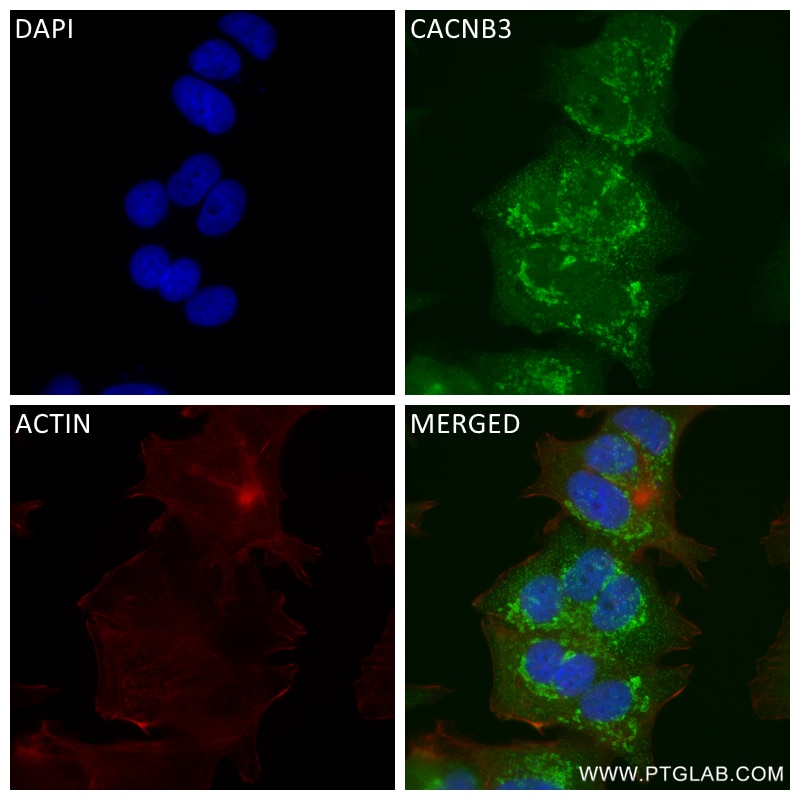 Immunofluorescence (IF) / fluorescent staining of MCF-7 cells using CACNB3 Recombinant antibody (84762-4-RR)