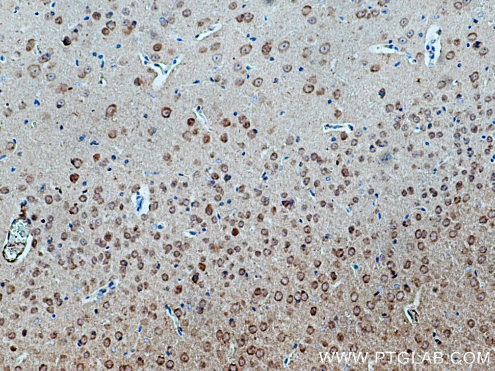 Immunohistochemistry (IHC) staining of mouse brain tissue using CACNB4 Polyclonal antibody (17770-1-AP)