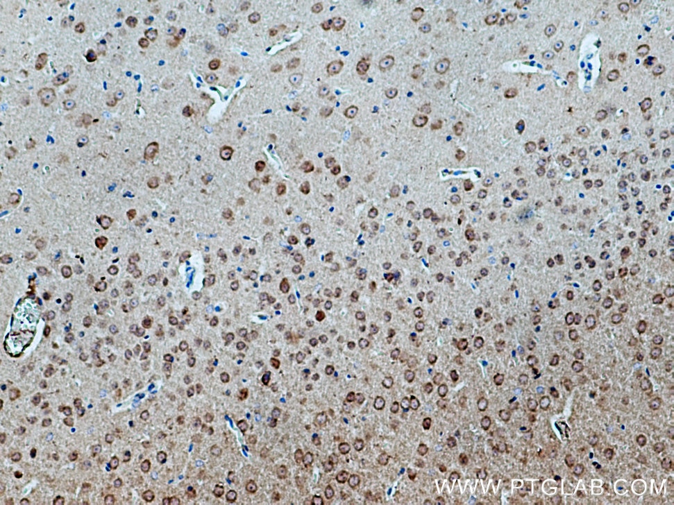 IHC staining of mouse brain using 17770-1-AP