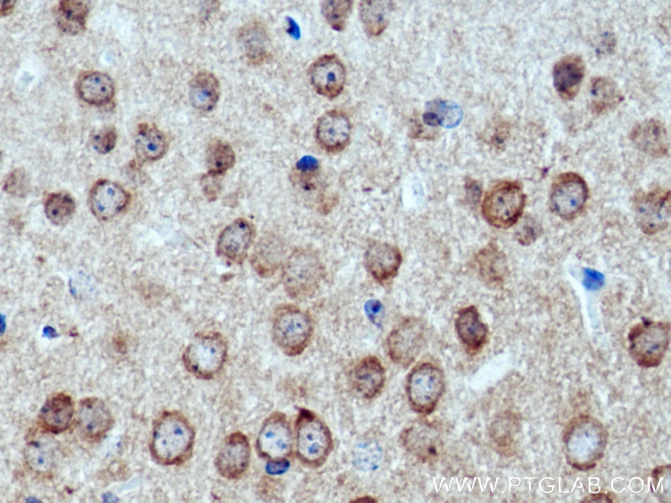 Immunohistochemistry (IHC) staining of mouse brain tissue using CACNB4 Polyclonal antibody (17770-1-AP)