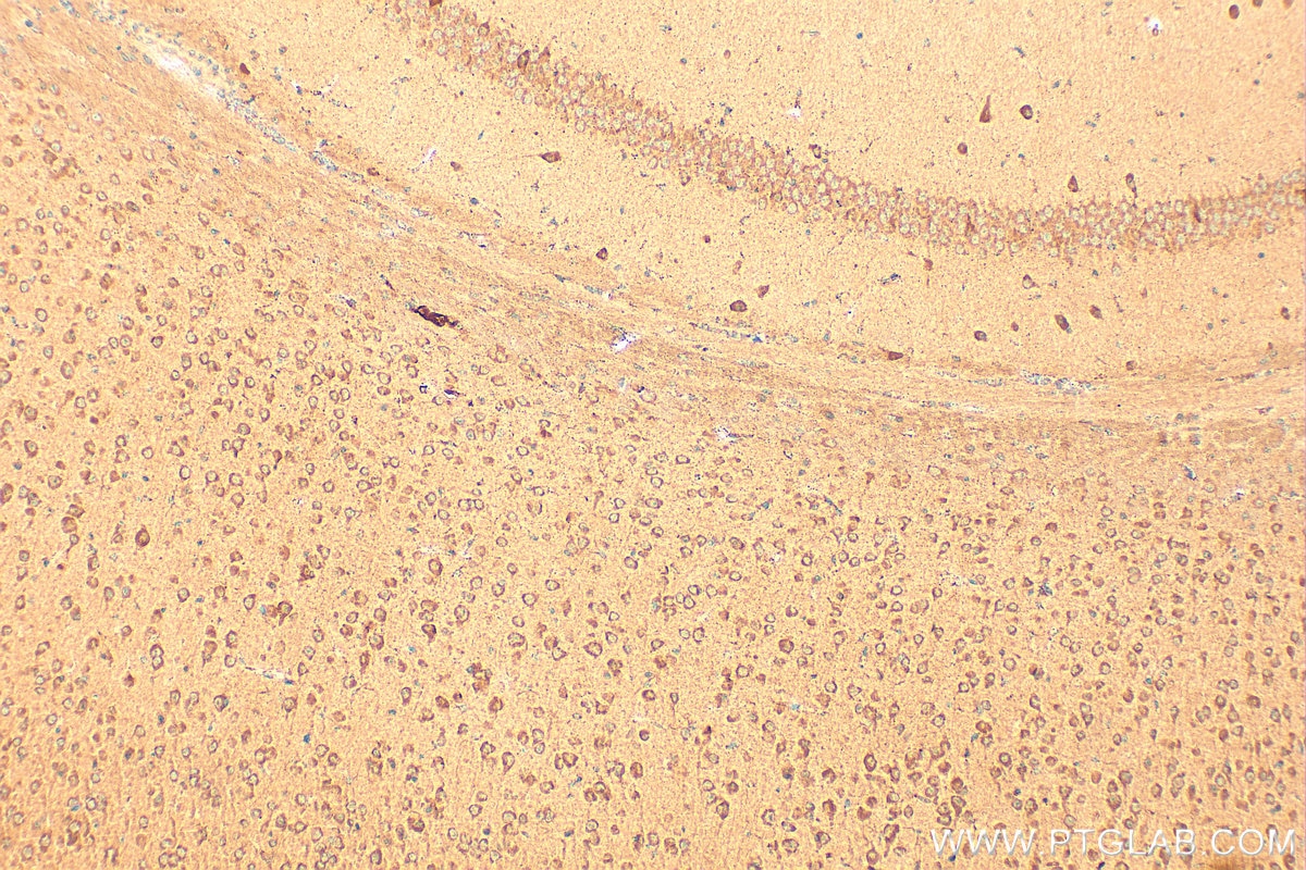 Immunohistochemistry (IHC) staining of mouse brain tissue using CACNB4 Polyclonal antibody (17770-1-AP)