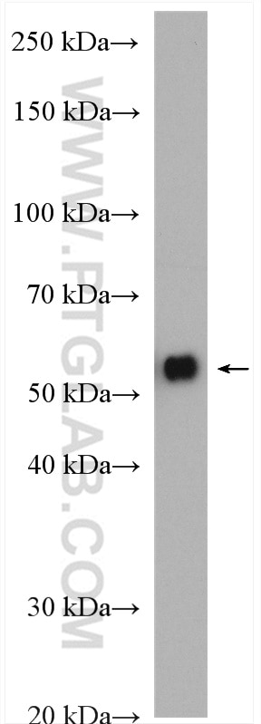 Western Blot (WB) analysis of rat brain tissue using CACNB4 Polyclonal antibody (17770-1-AP)