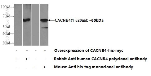 CACNB4