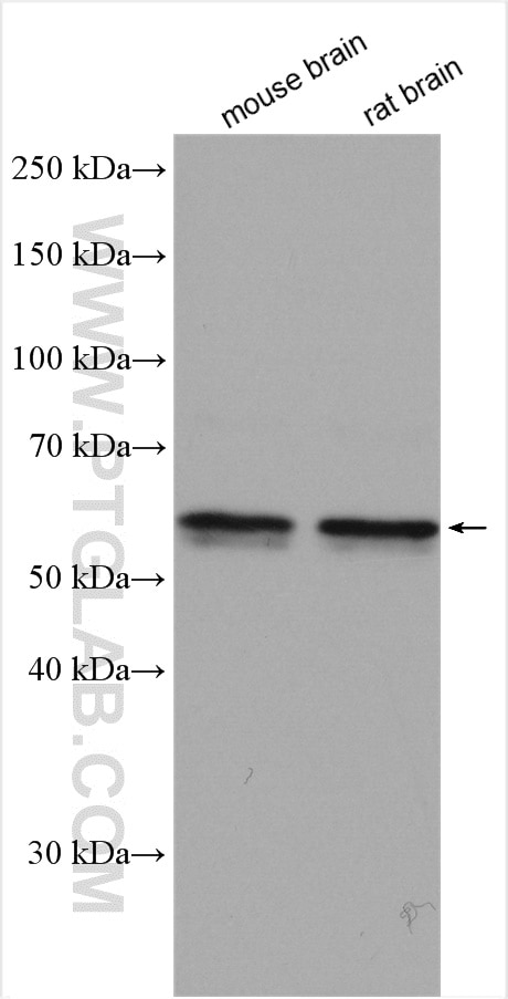 Western Blot (WB) analysis of various lysates using CACNB4 Polyclonal antibody (17770-1-AP)