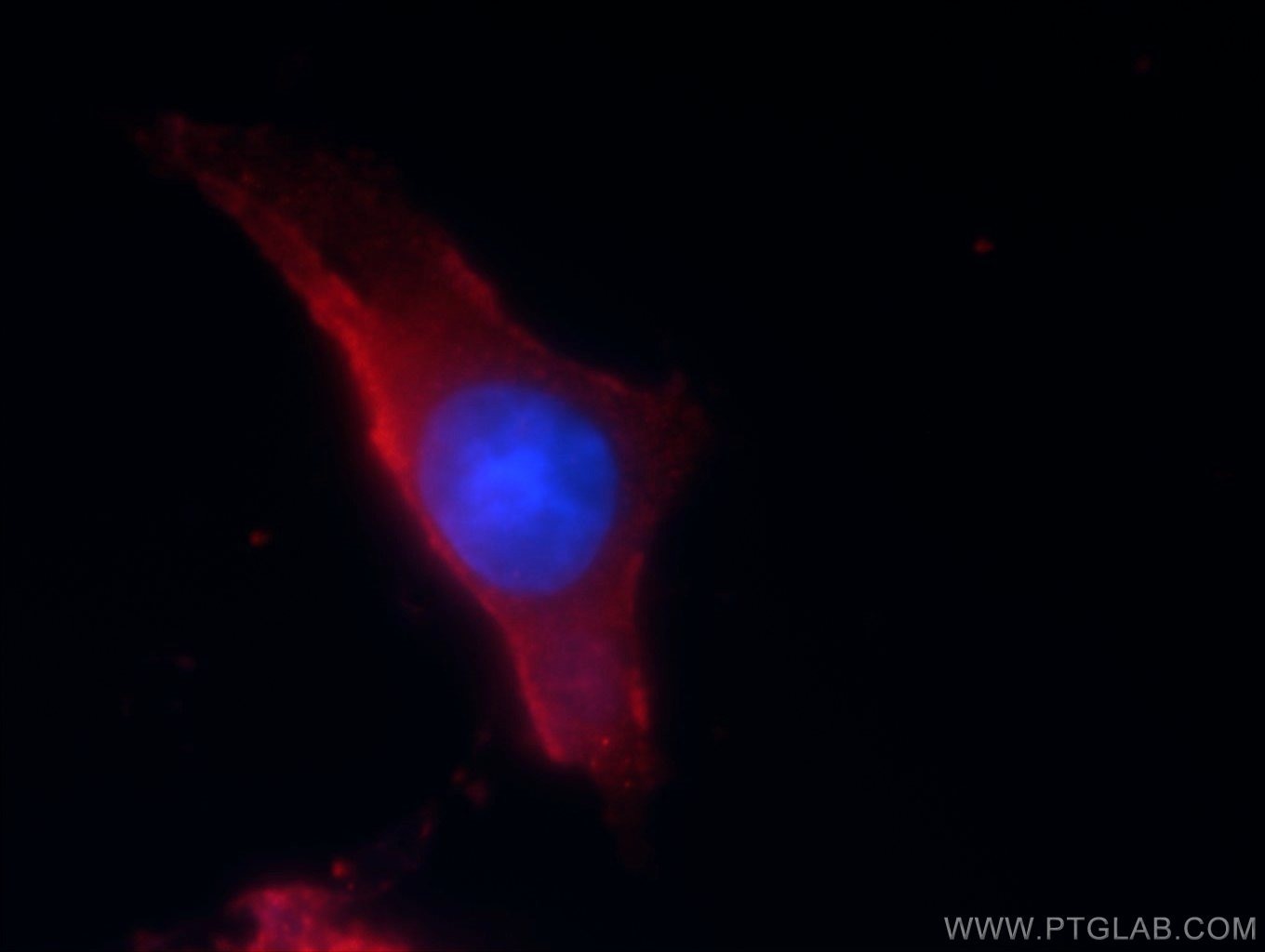 Immunofluorescence (IF) / fluorescent staining of SH-SY5Y cells using CACNG1 Polyclonal antibody (18389-1-AP)