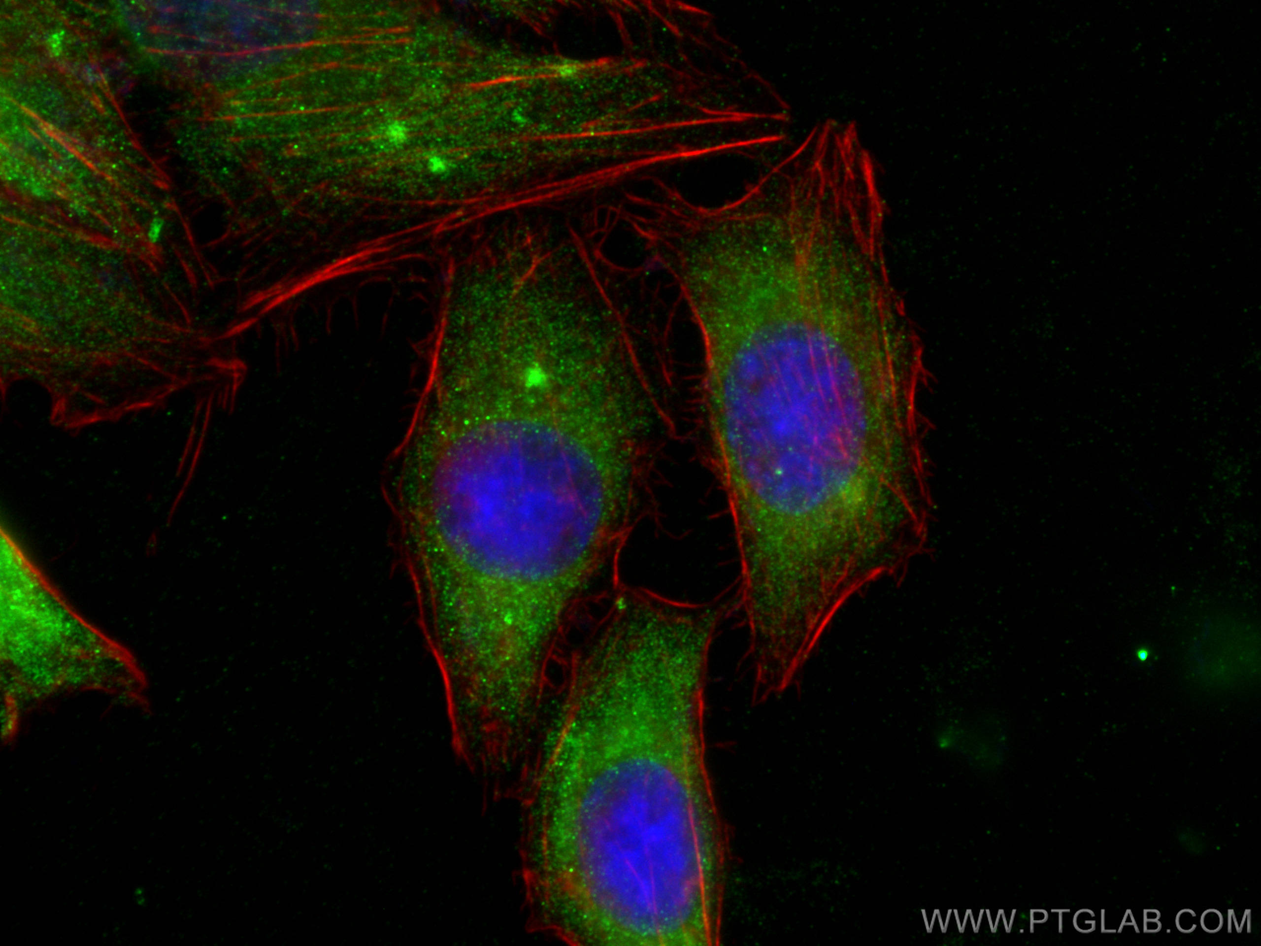 Immunofluorescence (IF) / fluorescent staining of HepG2 cells using CACNG1 Polyclonal antibody (18389-1-AP)