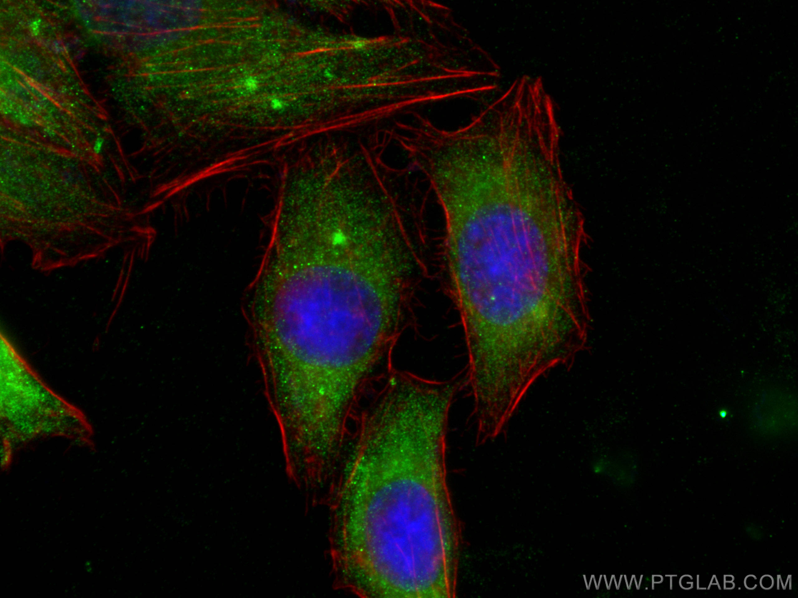 IF Staining of HepG2 using 18389-1-AP