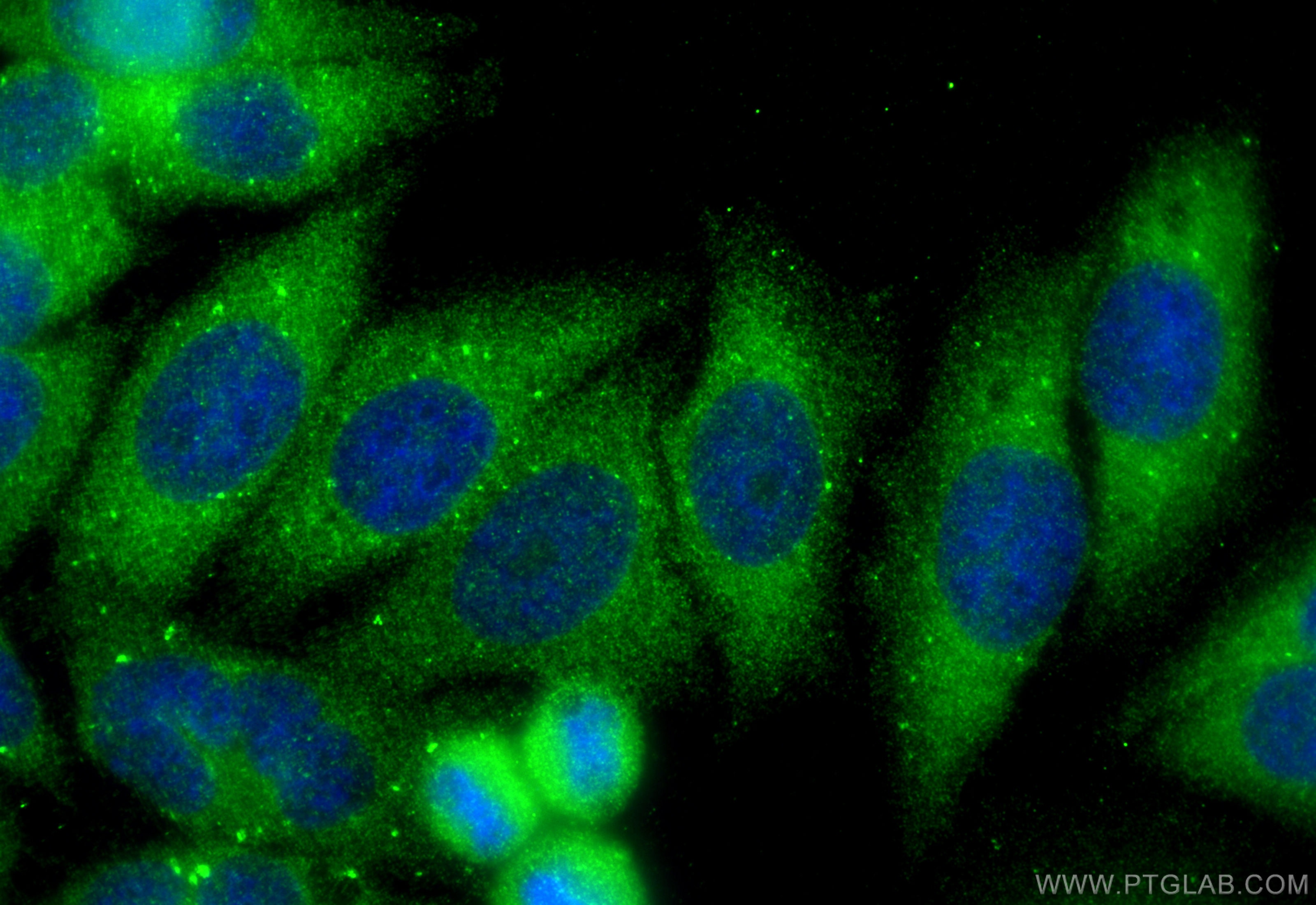 Immunofluorescence (IF) / fluorescent staining of HepG2 cells using CACNG1 Polyclonal antibody (18389-1-AP)