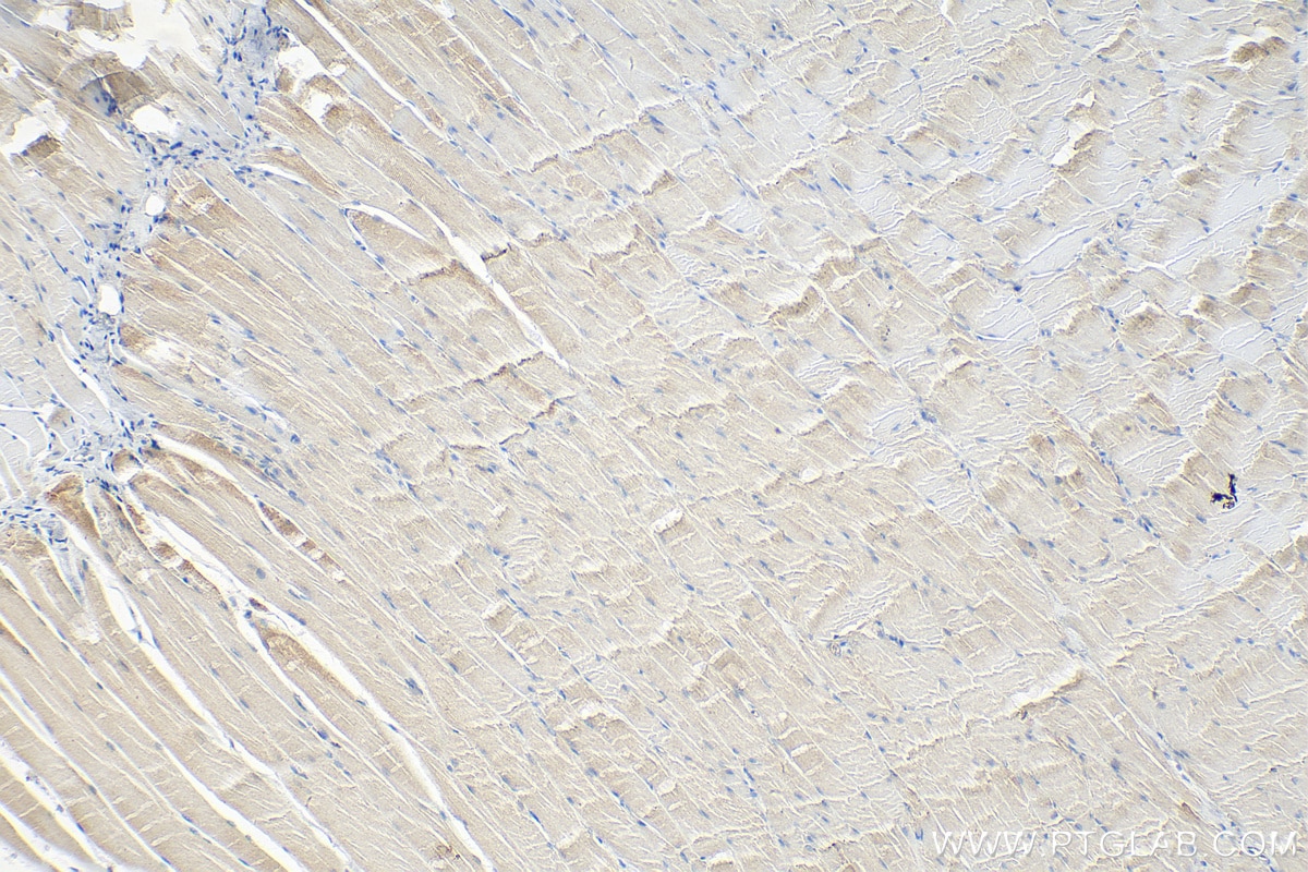 Immunohistochemistry (IHC) staining of rat skeletal muscle tissue using CACNG1 Polyclonal antibody (18389-1-AP)