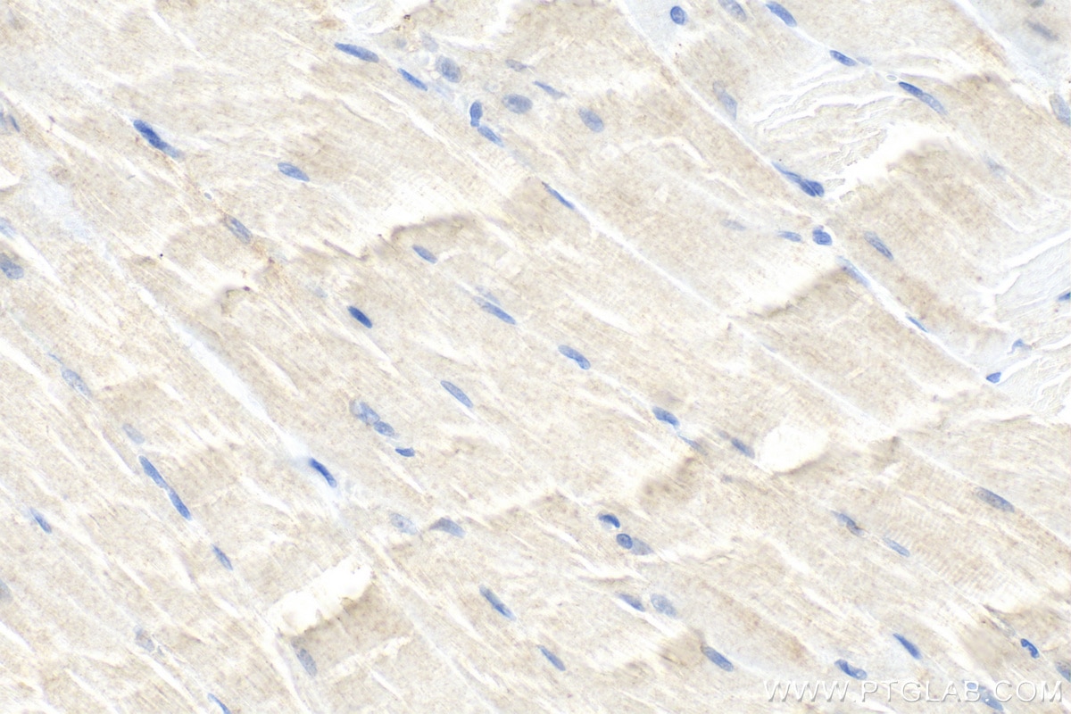 Immunohistochemistry (IHC) staining of rat skeletal muscle tissue using CACNG1 Polyclonal antibody (18389-1-AP)