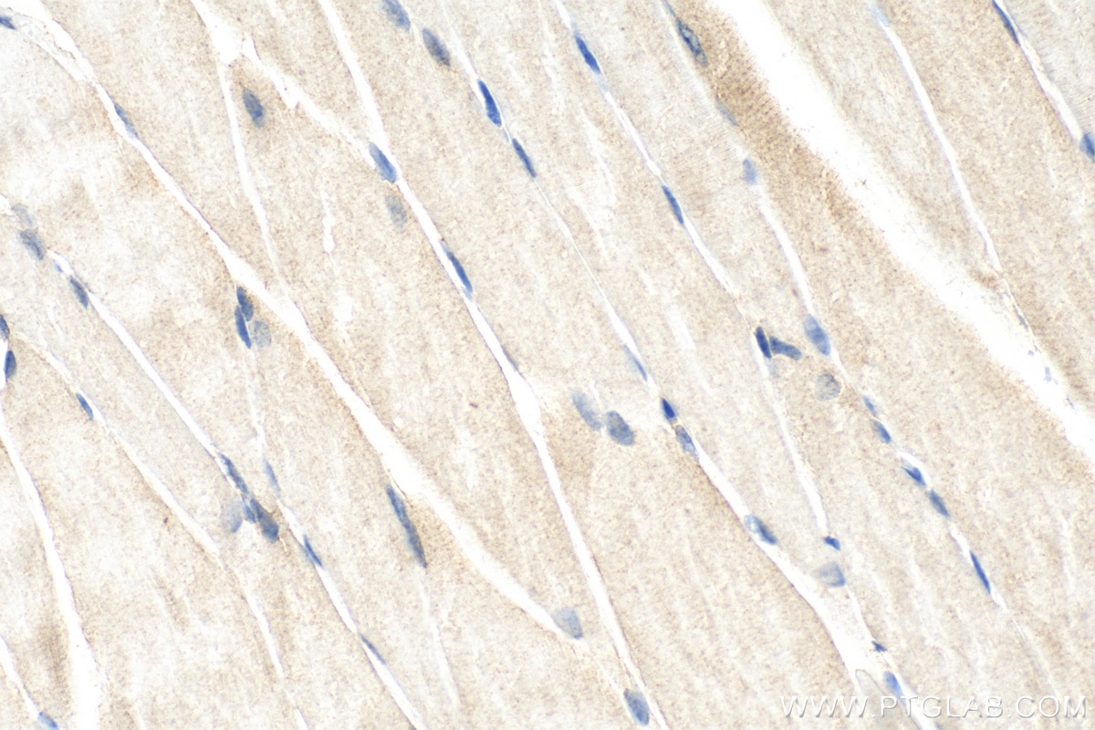 Immunohistochemistry (IHC) staining of mouse skeletal muscle tissue using CACNG1 Polyclonal antibody (18389-1-AP)