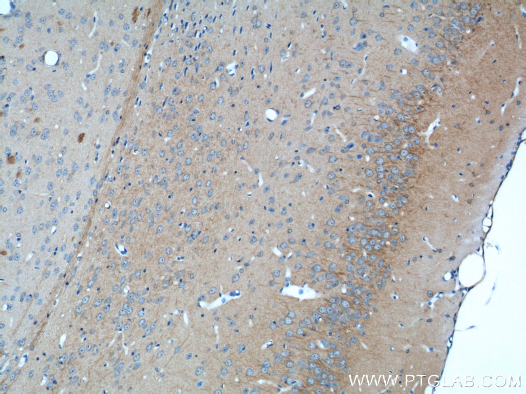 Immunohistochemistry (IHC) staining of mouse brain tissue using CACNG2 Polyclonal antibody (20969-1-AP)