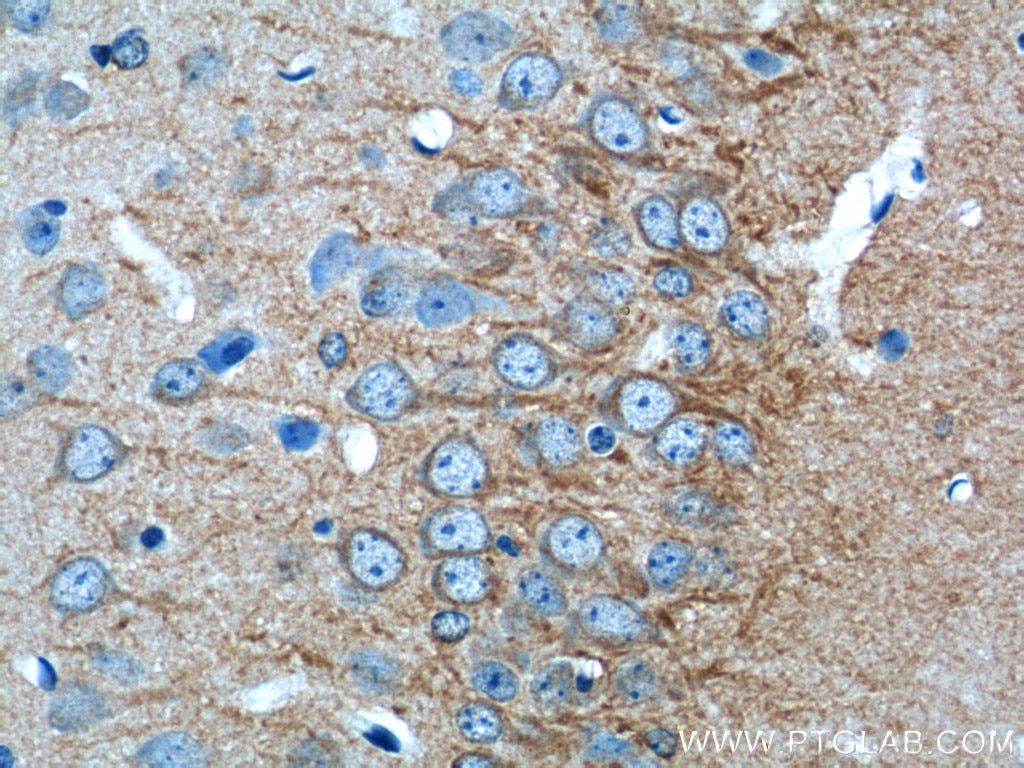 Immunohistochemistry (IHC) staining of mouse brain tissue using CACNG2 Polyclonal antibody (20969-1-AP)