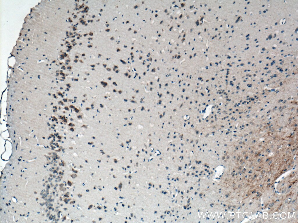 Immunohistochemistry (IHC) staining of mouse brain tissue using CACNG3 Polyclonal antibody (13729-1-AP)