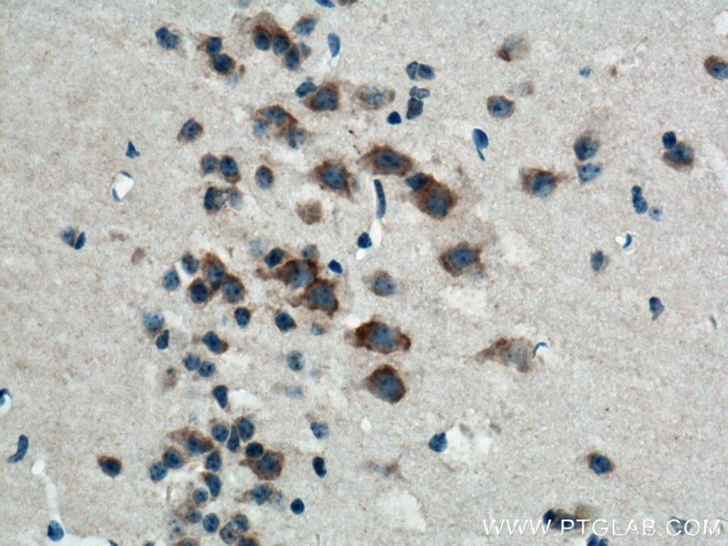 Immunohistochemistry (IHC) staining of mouse brain tissue using CACNG3 Polyclonal antibody (13729-1-AP)