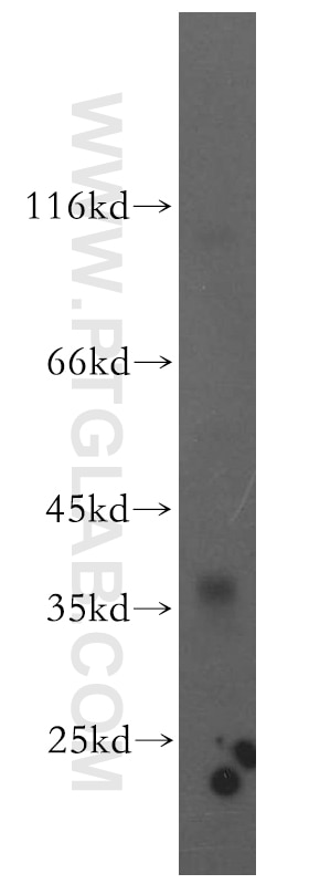 Western Blot (WB) analysis of human brain tissue using CACNG5 Polyclonal antibody (18498-1-AP)