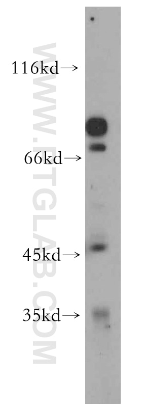 Western Blot (WB) analysis of SH-SY5Y cells using CACNG5 Polyclonal antibody (18498-1-AP)