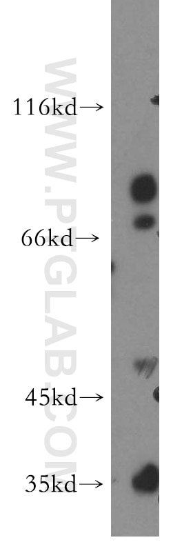 Western Blot (WB) analysis of SH-SY5Y cells using CACNG5 Polyclonal antibody (18498-1-AP)