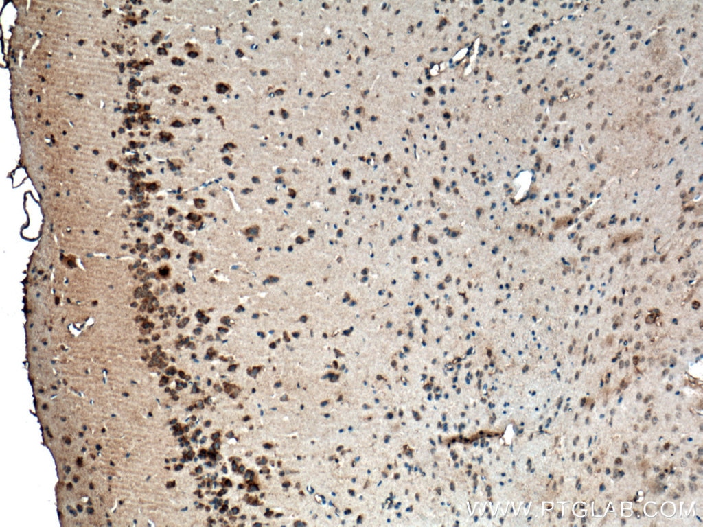 Immunohistochemistry (IHC) staining of mouse brain tissue using CACNG7 Polyclonal antibody (17862-1-AP)