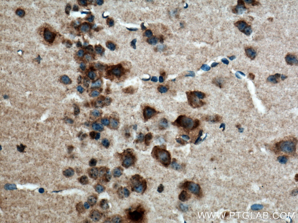 Immunohistochemistry (IHC) staining of mouse brain tissue using CACNG7 Polyclonal antibody (17862-1-AP)