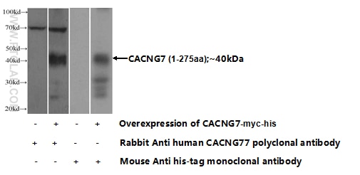 CACNG7 Polyclonal antibody