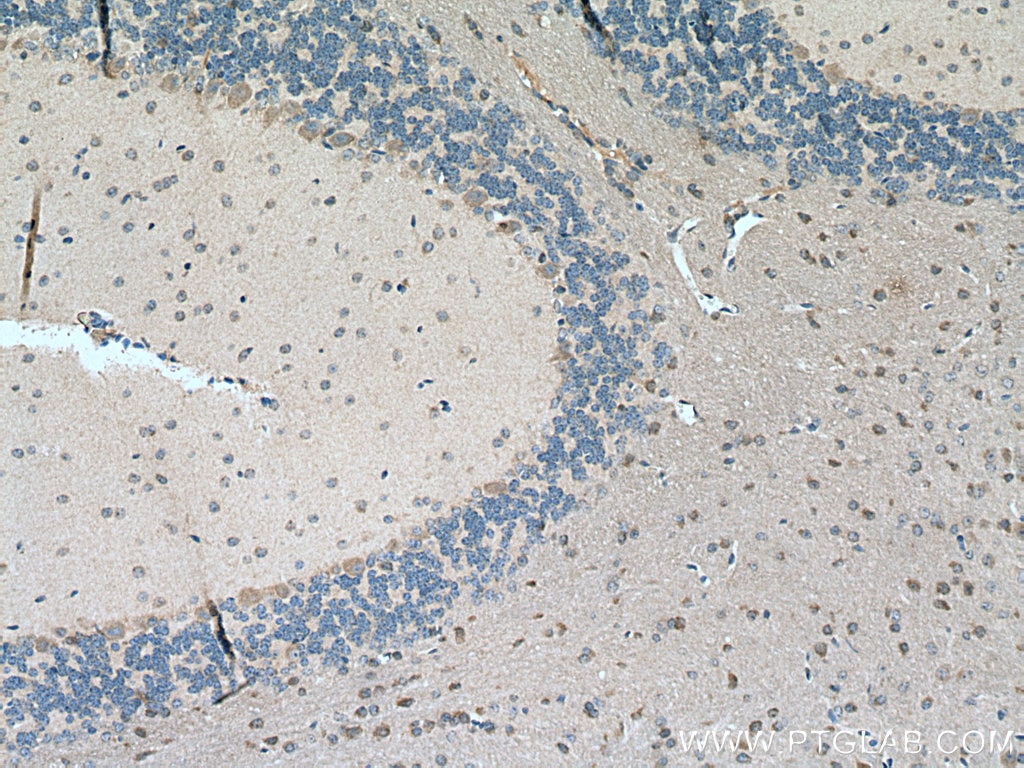 Immunohistochemistry (IHC) staining of mouse cerebellum tissue using CACNG8 Polyclonal antibody (55078-1-AP)