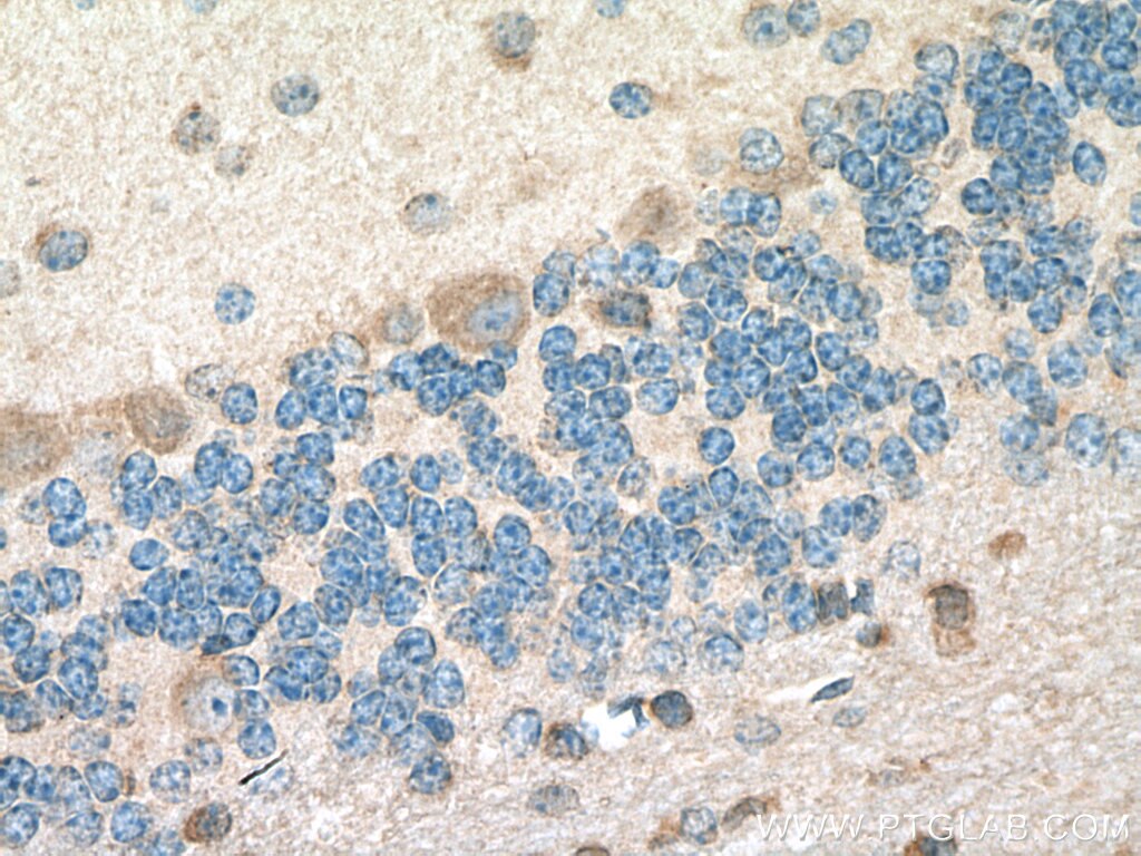 Immunohistochemistry (IHC) staining of mouse cerebellum tissue using CACNG8 Polyclonal antibody (55078-1-AP)