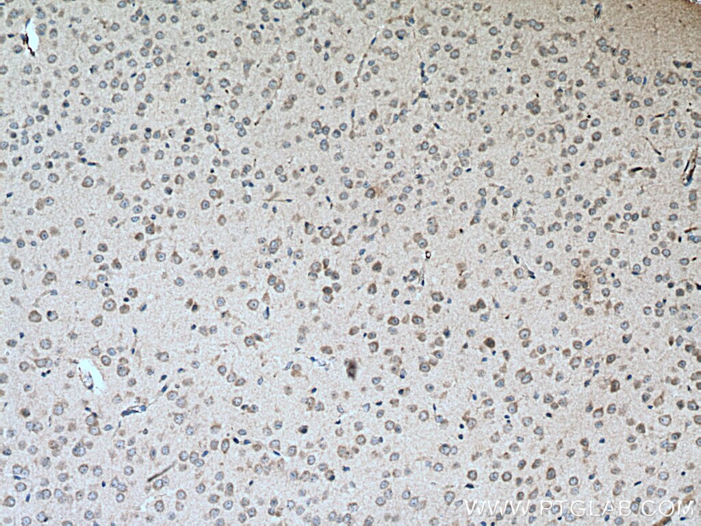 Immunohistochemistry (IHC) staining of mouse brain tissue using CACNG8 Polyclonal antibody (55078-1-AP)