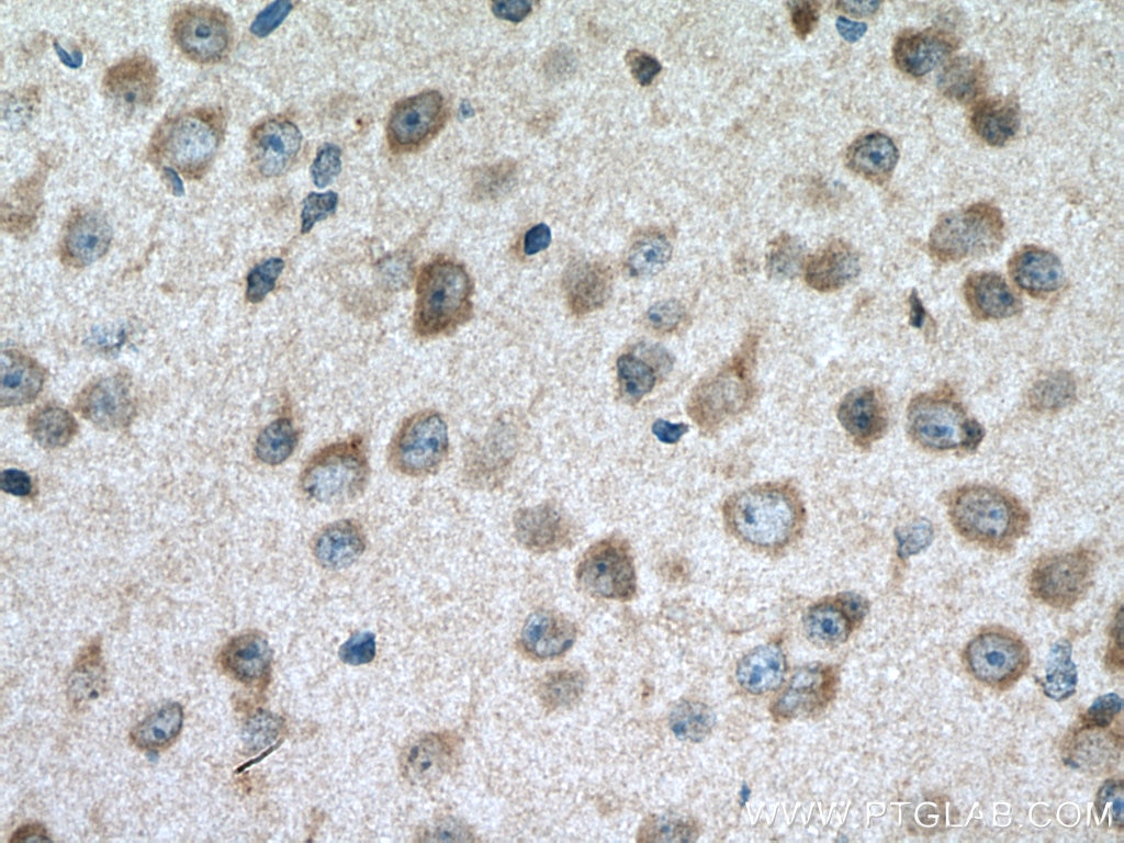 Immunohistochemistry (IHC) staining of mouse brain tissue using CACNG8 Polyclonal antibody (55078-1-AP)