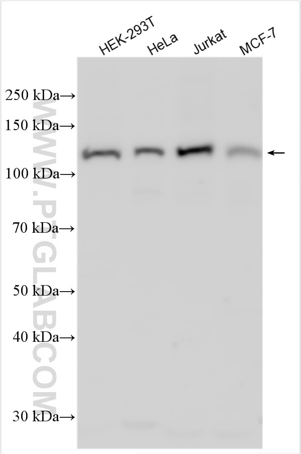 Western Blot (WB) analysis of various lysates using CACTIN Polyclonal antibody (32066-1-AP)