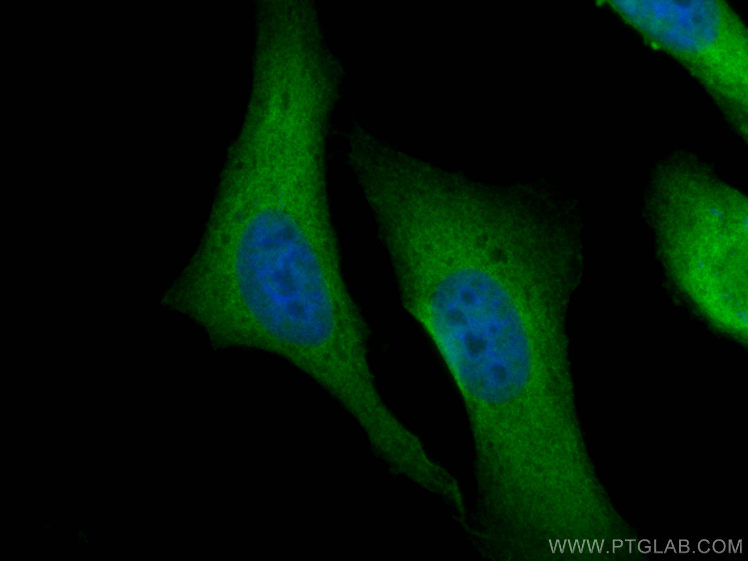 Immunofluorescence (IF) / fluorescent staining of HeLa cells using CACYBP Polyclonal antibody (11745-1-AP)