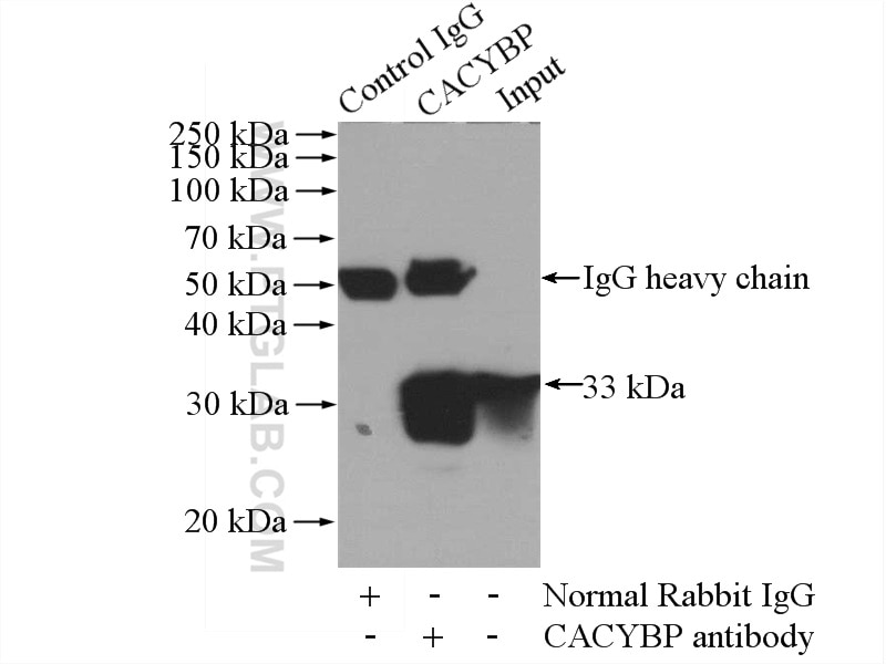 Immunoprecipitation (IP) experiment of mouse brain tissue using CACYBP Polyclonal antibody (11745-1-AP)