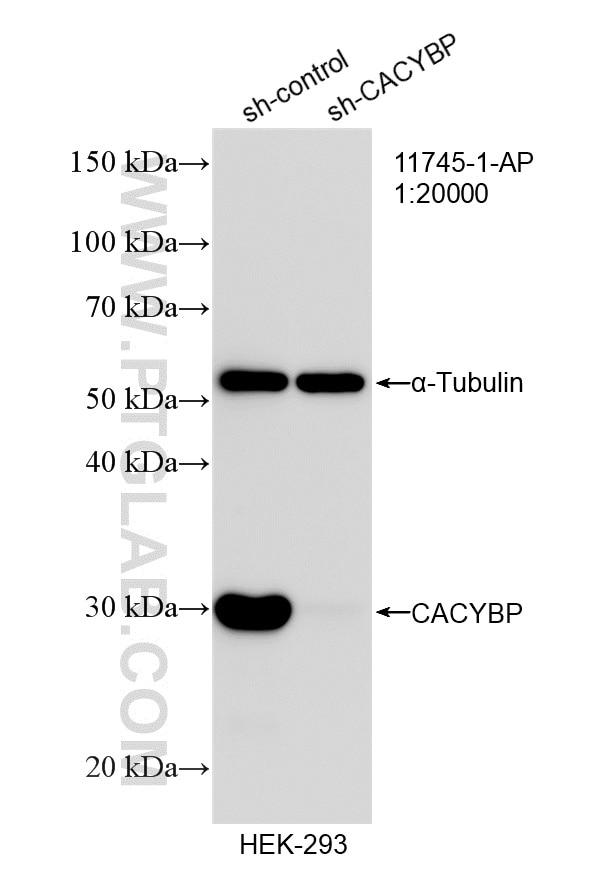 Western Blot (WB) analysis of HEK-293 cells using CACYBP Polyclonal antibody (11745-1-AP)