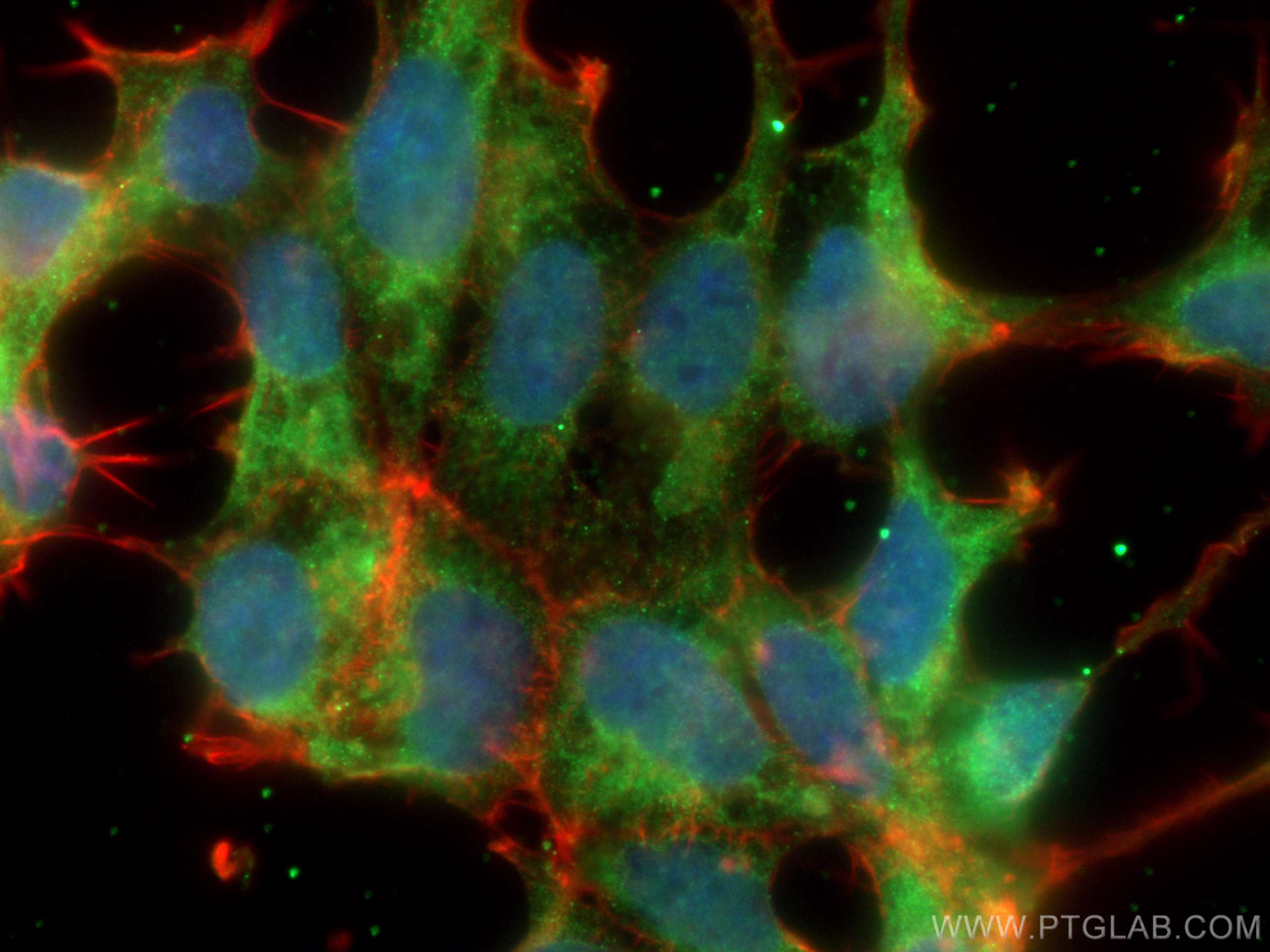 Immunofluorescence (IF) / fluorescent staining of HEK-293 cells using CACYBP Monoclonal antibody (68161-1-Ig)