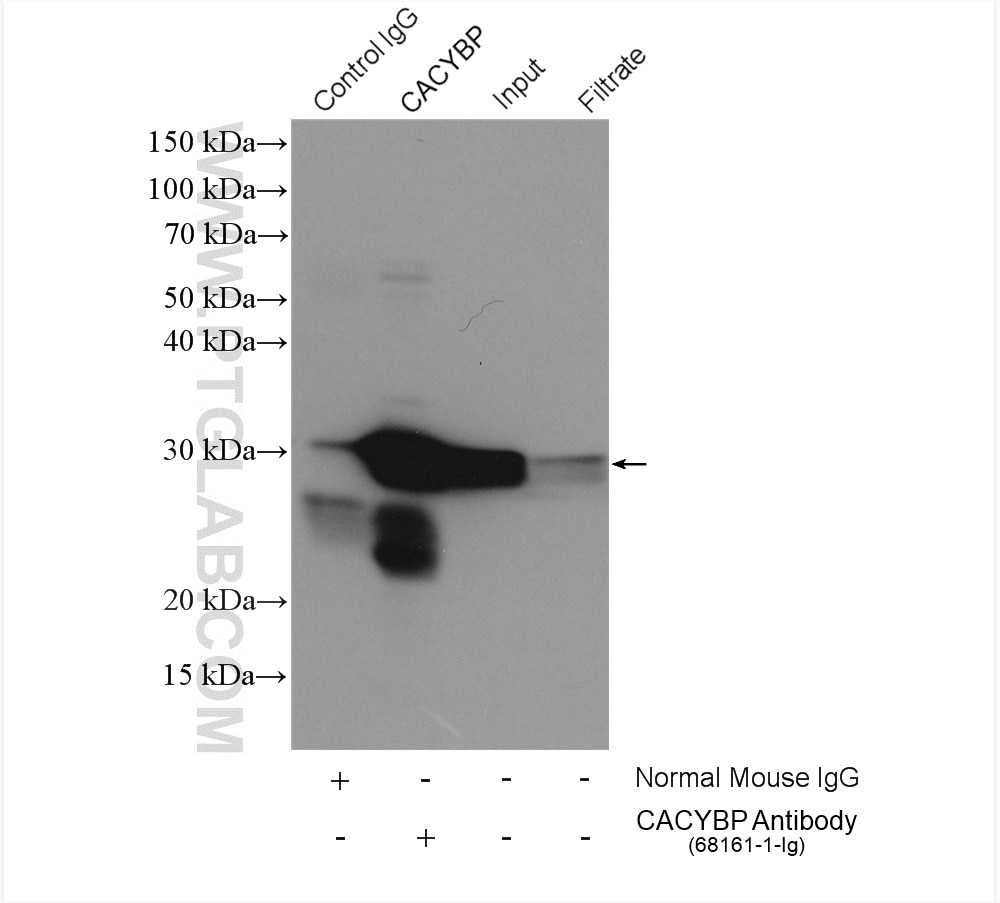 Immunoprecipitation (IP) experiment of HeLa cells using CACYBP Monoclonal antibody (68161-1-Ig)
