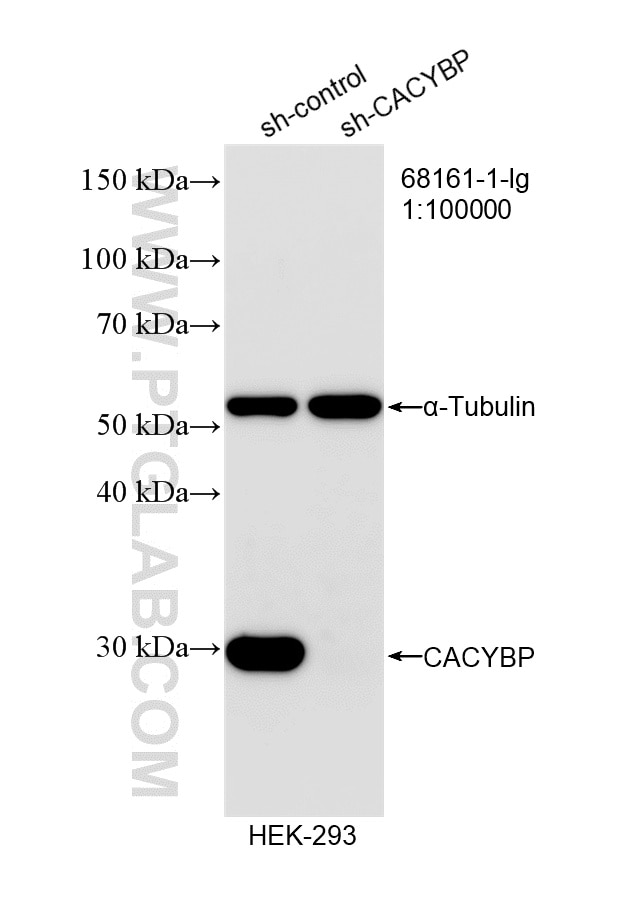 Western Blot (WB) analysis of HEK-293 cells using CACYBP Monoclonal antibody (68161-1-Ig)